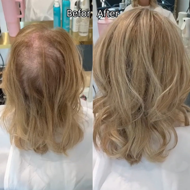 🌷 Final Hours –🌷2026 New Lightweight & Breathable Wavy Hair Topper
